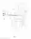 Fig. 02 - Bone alignment implant and method of use