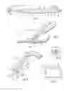 Fig. 02 - Medical Tool For Cutting a Hard Material Wall and Method of Cutting