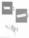 Fig. 02 - Non-resorbable implantable guides