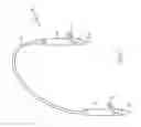 Fig. 02 - SUTURE ANCHORING SYSTEM