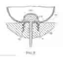 Fig. 04 - SUTURE ANCHORING SYSTEM