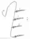 Fig. 05 - SUTURE ANCHORING SYSTEM