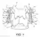Fig. 02 - Spine stabilization system with dynamic screw