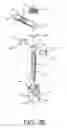 Fig. 05 - Spine stabilization system with dynamic screw