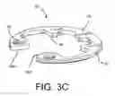 Fig. 06 - Spine stabilization system with dynamic screw