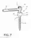Fig. 10 - Spine stabilization system with dynamic screw