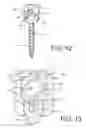 Fig. 13 - Spine stabilization system with dynamic screw