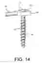 Fig. 14 - Spine stabilization system with dynamic screw