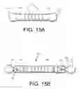 Fig. 15 - Spine stabilization system with dynamic screw