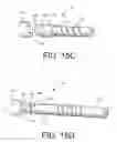 Fig. 16 - Spine stabilization system with dynamic screw