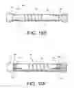 Fig. 17 - Spine stabilization system with dynamic screw