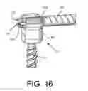 Fig. 18 - Spine stabilization system with dynamic screw