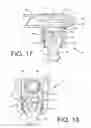 Fig. 19 - Spine stabilization system with dynamic screw