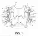 Fig. 02 - Spinal anchoring screw