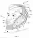 Fig. 02 - Facial Cold -Pack Holder