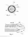 Fig. 04 - Delivery system and sheath for endoluminal prosthesis