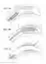 Fig. 02 - Bioerodible endoprostheses and methods of making the same