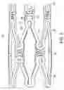 Fig. 07 - Apparatus and Method for Delivery of Mitomycin Through an Eluting Biocompatible Implantable Medical Device
