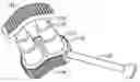 Fig. 01 - Selectively expanding spine cage, hydraulically controllable in three dimensions for vertebral body replacement