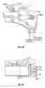 Fig. 08 - Selectively expanding spine cage, hydraulically controllable in three dimensions for vertebral body replacement