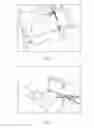 Fig. 06 - Method and associated system for recording and retrieving fabrication and/or fitting data associated with a prosthetic component
