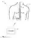 Fig. 02 - User interface with toolbar for programming electrical stimulation therapy