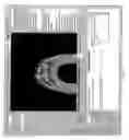 Fig. 07 - Dynamically specifying a view