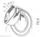 Fig. 07 - Length-ways stretchable elastic band