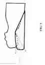Fig. 06 - Head and upper neck support device