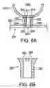 Fig. 06 - Extrusion method for fabricating a compact tube with internal features