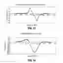Fig. 09 - ELECTROMAGNETIC PIEZOELECTRIC ACOUSTIC SENSOR