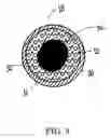 Fig. 10 - Projectile, projectile core, and method of making