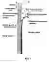 Fig. 09 - Method and system of electromagnetic stirring for continuous casting of medium and high carbon steels