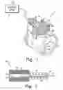 Fig. 02 - Valve assembly with overstroke device and associated method