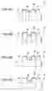 Fig. 10 - FEED ROLLER, MANUFACTURING METHOD OF FEED DRIVE ROLLER, RECORDING APPARATUS