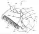 Fig. 01 - Box lifting devices