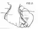 Fig. 03 - Box lifting devices