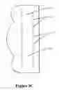 Fig. 06 - Box lifting devices