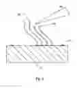 Fig. 04 - Probe structure having a plurality of discrete insulated probe tips projecting from a support surface, apparatus for use thereof and methods of fabrication thereof