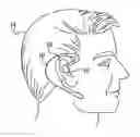 Fig. 01 - Ear-mounted biosensor