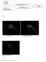 Fig. 02 - Method for identifying the activation of the brake lights of preceding vehicles