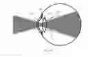 Fig. 04 - Working distance and alignment sensor for a fundus camera