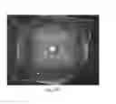 Fig. 09 - Working distance and alignment sensor for a fundus camera