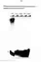 Fig. 02 - NOVEL HUMAN POLY(A)POLYMERASE GAMMA (PAP GAMMA)