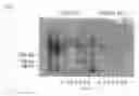 Fig. 04 - Method of inducing genome reorganization via intracellular activation of thermostable multifrequency DNA-cleaving enzyme