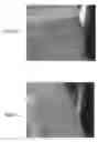 Fig. 02 - METHODS OF TREATING SKIN DISORDERS WITH CAFFEIC ACID ANALOGS