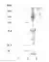 Fig. 01 - Extraction Of Gelatin