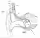 Fig. 01 - Implantable microphone having sensitivity and frequency response