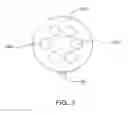 Fig. 04 - Implantable microphone having sensitivity and frequency response