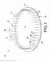 Fig. 02 - Prosthetic repair patch with integrated sutures